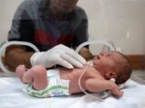 Bebê é resgatado do ventre de palestina grávida que morreu após bombardeio