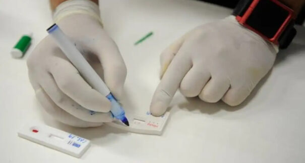 Hepatite B terá notificação compulsória para gestantes