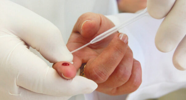 Saúde orienta farmácias sobre testes para HIV, sífilis e hepatites