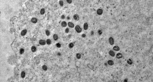 Mpox: Argentina põe em quarentena navio que deixou Brasil