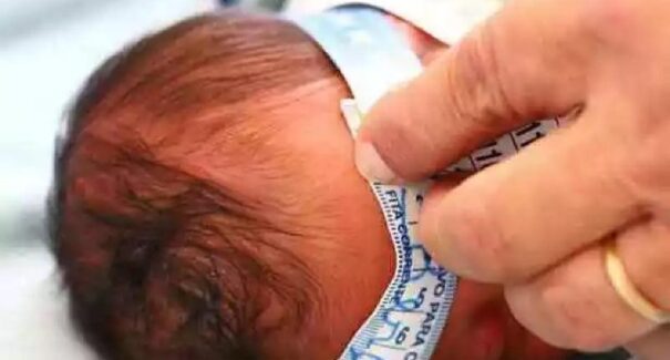 Medida provisória estabelece o pagamento de R$ 60 mil a famílias de crianças afetadas pelo Zika
