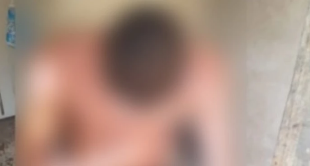 Mulher ateia fogo no ex-namorado após ser agredida em São Luís