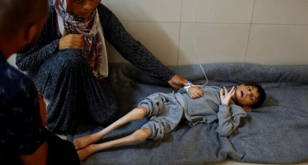 FAO aponta que fome chegou a pior patamar em Gaza