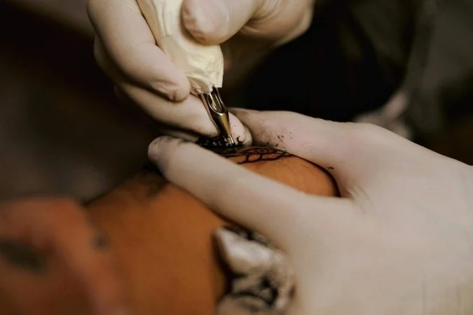 Segundo o documento, o médico não pode aplicar sedação, anestesia geral ou bloqueios anestésicos periféricos, independente do local ou tamanho da tatuagem (Foto: Ló Juan/Pexels)
