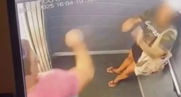 Mulher espancada pelo ex em elevador reconstrói face em cirurgia de 9 horas