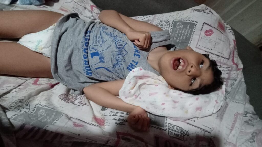 João tem 8 anos, possui diagnóstico de microcefalia e agora está com adenoide, um tecido que cresce atrás do nariz e pode dificultar a respiração, o sono e causar infecções (Foto: Divulgação)