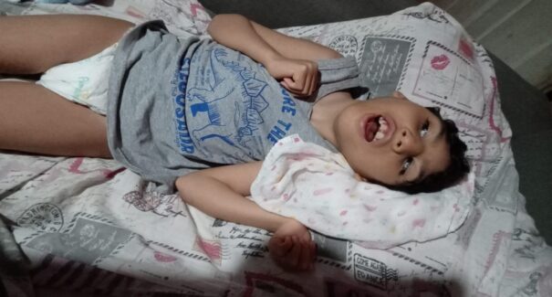 Ajuda para João Gabriel: menino tem 8 anos, diagnóstico de Microcefalia, e está com adenoide
