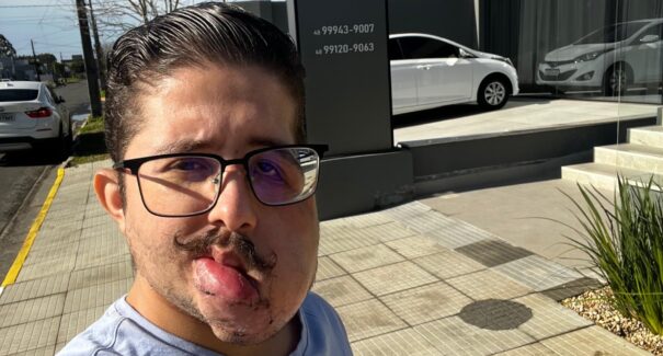 Maranhense faz vaquinha virtual para custear despesas com cirurgias