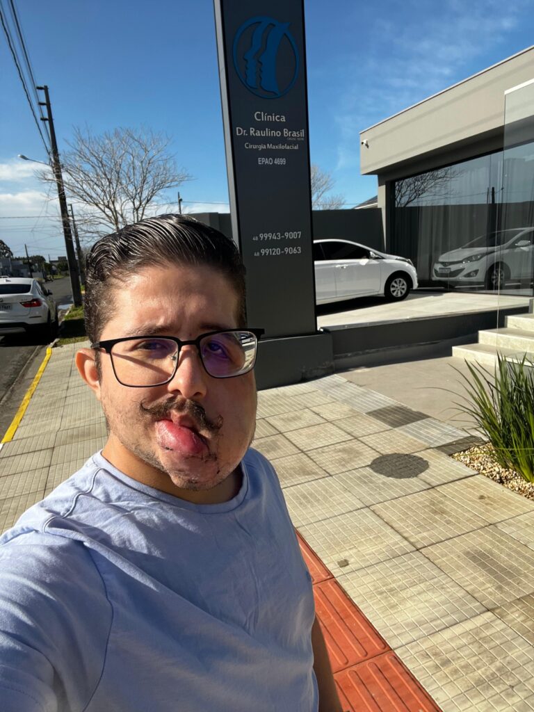 Henrique tem uma deficiência física que o acomete desde os 4 anos. (crédito: divulgação)