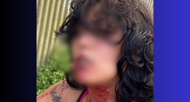 Homem é preso por arrancar parte da boca da namorada