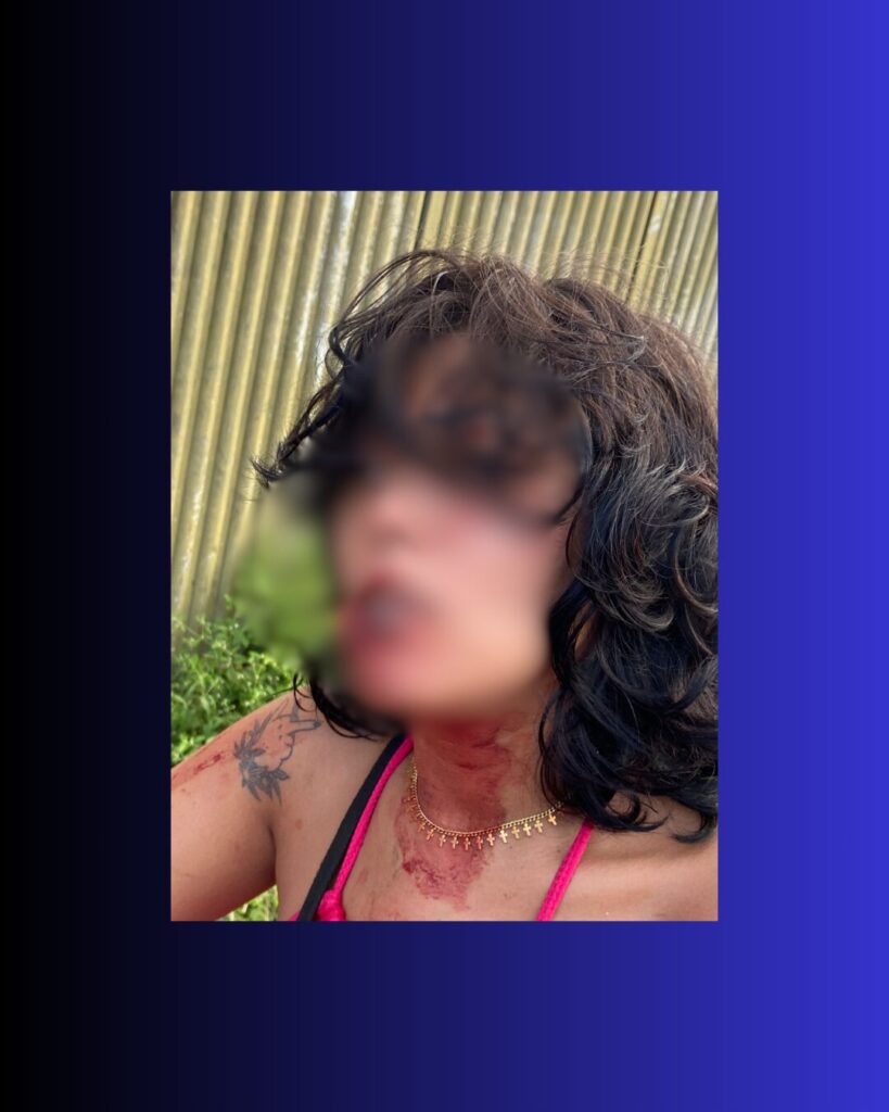 Homem é preso por arrancar parte da boca da namorada