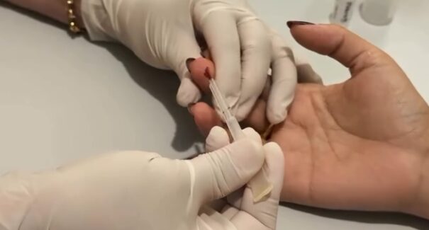 Prefeitura de Grajaú realiza testagem e ações de prevenção ao HIV durante o Dezembro Vermelho