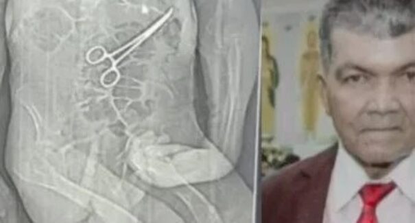 Homem morre após cirurgia e família diz que pinça foi deixada no corpo