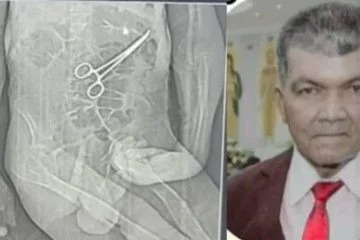 Idoso morre na véspera do Natal e família denuncia pinça esquecida dentro do corpo durante cirurgia em MG (Foto: Reprodução/Redes Sociais)
