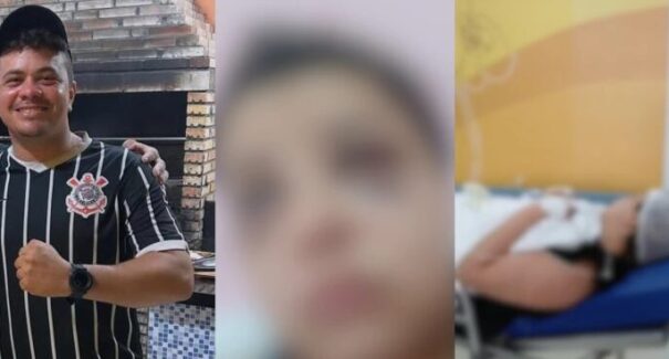 Justiça decreta prisão de suspeito de tentar matar enfermeira na Cidade Operária