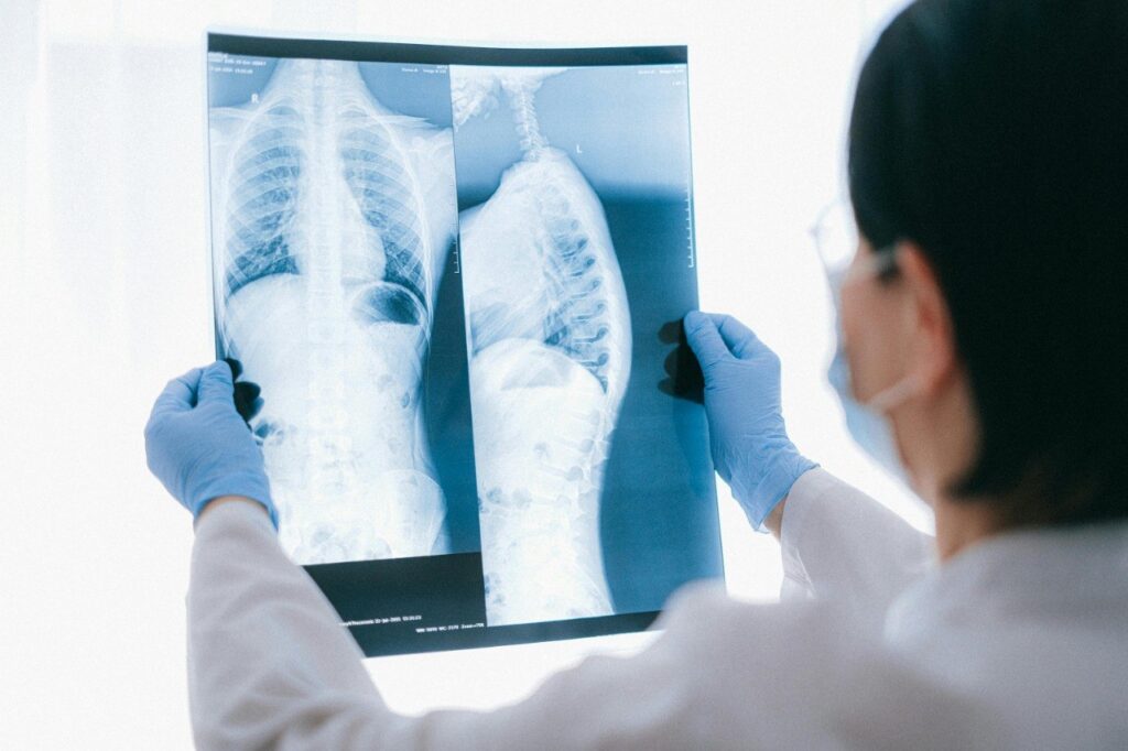 Crescente nos casos de tuberculose nos últimos no Maranhão chama atenção de especialistas (Foto: Divulgação)