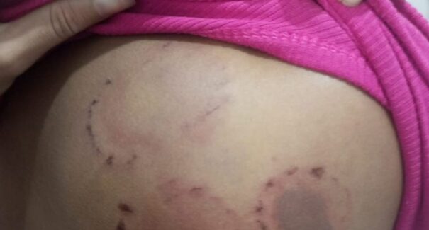 Homem é preso em flagrante após agredir companheira com socos e mordidas em Pinheiro