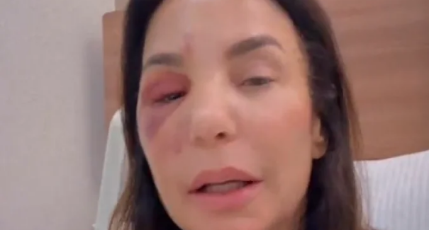 Após cirurgia, Ivete Sangalo atualiza fãs sobre estado de saúde