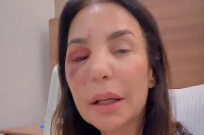 Após cirurgia, Ivete Sangalo atualiza fãs sobre estado de saúde