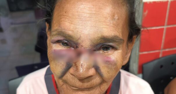 Agressão covarde: idosa de 68 anos é espancada e filho é investigado por omissão
