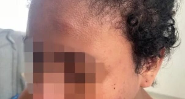 “Minha preocupação era o meu filho”, diz doméstica agredida por patroa na Grande São Luís