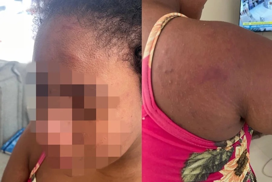 O tema ganhou destaque na imprensa nos últimos dias devido ao caso de uma trabalhadora doméstica de 19 anos, grávida, que denunciou ter sido vítima de agressões e tortura (Foto: PC-MA)
